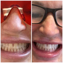 The Lifestyle Society - Before after