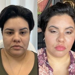 Beau-Tox Esthetics