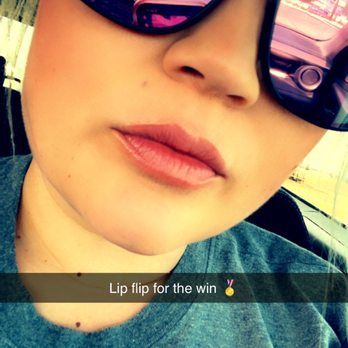 Skinmedology - Lip flip aka poppin pout - Medical Spas Near Me - Ventura, California Skinmedology - Lip flip aka poppin pout - Medical Spas Near Me - Ventura, California
