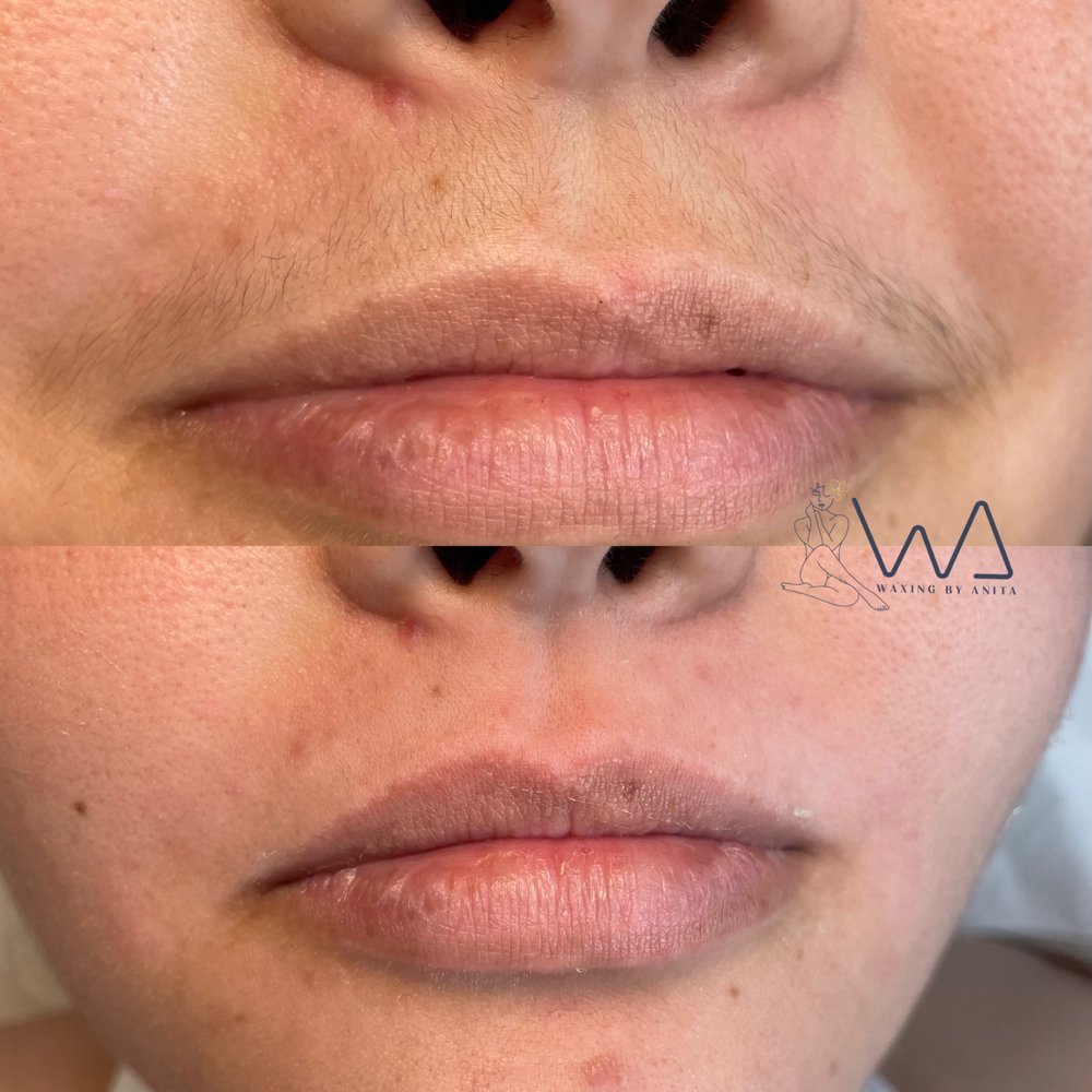 WAXING BY ANITA Request an Appointment 8281 SW 124th St, Pinecrest