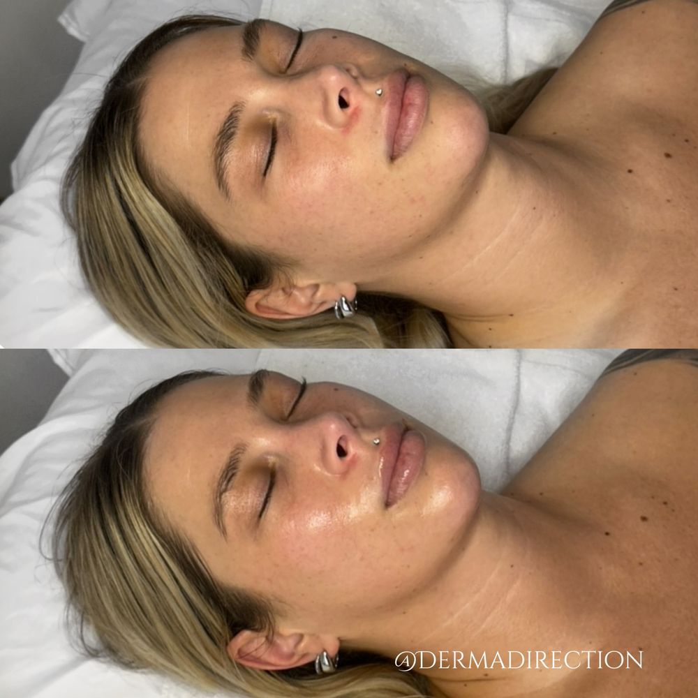 Derma Direction Logo