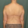 Photo of Plastic Surgery Body Contouring Center