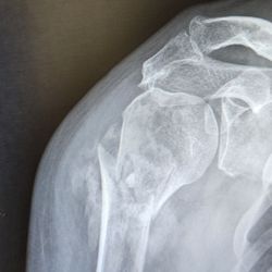 Rothman Orthopaedics