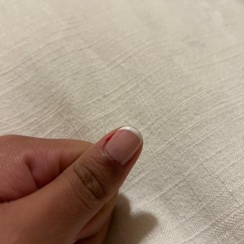 Lush Nails Spa - The cuticle that was bleeding: - Nail Salons Near Me - Vancouver, Washington
