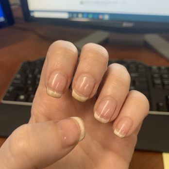 Begins Nail Spa - After one week - Nail Salons Near Me - Warwick, Rhode Island Begins Nail Spa - After one week - Nail Salons Near Me - Warwick, Rhode Island