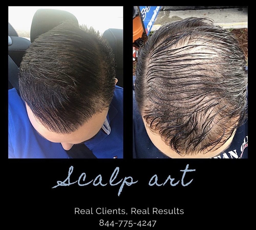 SCALP LOGIC 96 Photos & 15 Reviews 20842 US 59, New Caney