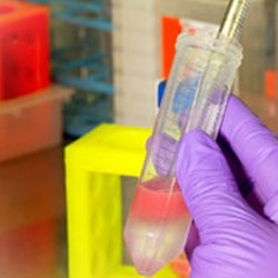 Robert Nagourney, MD - Nagourney Cancer Institute - Functional profiling testing of your cancer cells