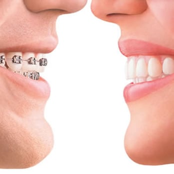 Galen T Callender DDS - Orthodontists Near Me - Arvada, Colorado Galen T Callender DDS - Orthodontists Near Me - Arvada, Colorado