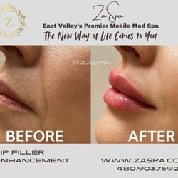 ZaSpa - Lip Filler with a perfect pout. She loved it