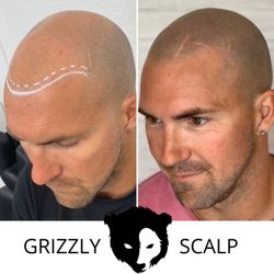 Grizzly Scalp