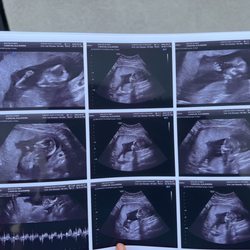 Forever Yours Ultrasound - Ultrasound pics