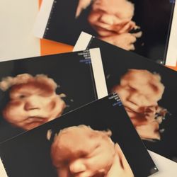Motherhood Ultrasound