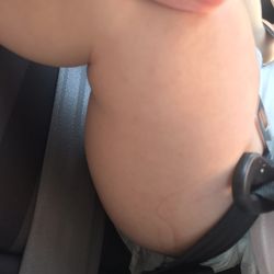 El Carmen Medical Clinic - Won't see my daughter with hives
