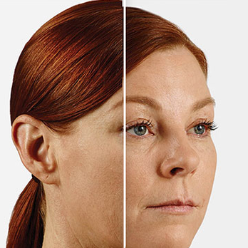 Joel Beauty - Medical Spas Near Me - New York, New York Joel Beauty - Medical Spas Near Me - New York, New York