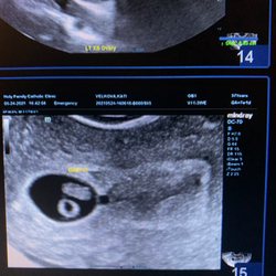 Holy Family Catholic Clinic - 7 weeks pregnant and they were able to show me my baby's heartbeat