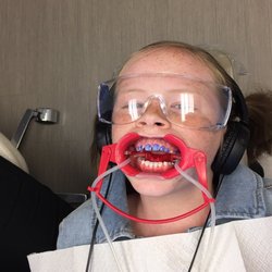 Jeff Chandler - Foothill Orthodontics - Watching a movie and straightening her teeth at the same time.