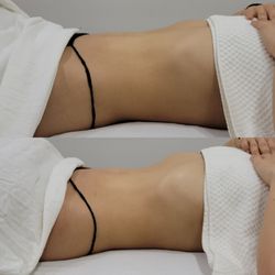 Bodyby_emilyg - Brazilian Lymphatic Drainage first-time client results