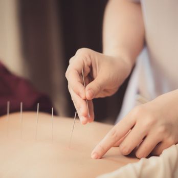 Center For Natural Healing - Naturopathic/Holistic Near Me - Monroe, Connecticut Center For Natural Healing - Naturopathic/Holistic Near Me - Monroe, Connecticut