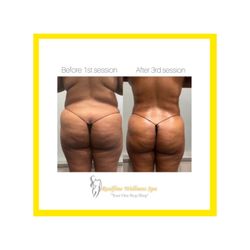 Realfine Wellness Spa - Mommy Make Over Complete!!