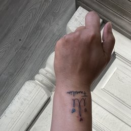 Still in the healing process Still in the healing process