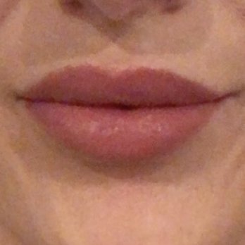 About Face Aesthetics - Slight smile - Skin Care Near Me - Philadelphia, Pennsylvania About Face Aesthetics - Slight smile - Skin Care Near Me - Philadelphia, Pennsylvania