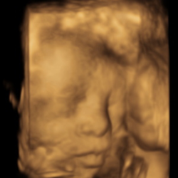 Classy Babie - 3D Ultrasound photo