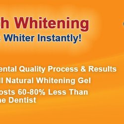 Sensational Smiles - Mobile Teeth Whitening