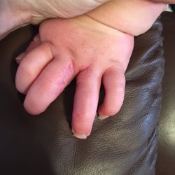 Rocky Mountain Pediatric OrthoONE