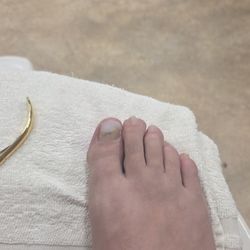 Lee Nails - This is the toenail that got rebuilt.