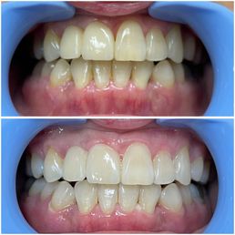 Top s16 to bottom s12/10! Top s16 to bottom s12/10!