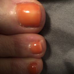 They look terrible. They look terrible.