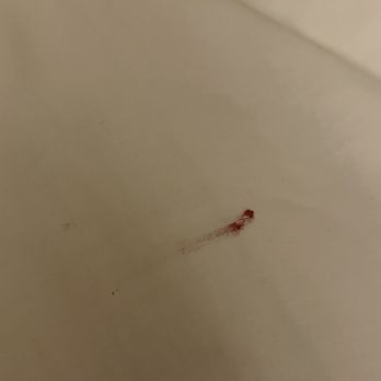 Great Wolf Lodge - Blood on blanket - Resorts Near Me - Fitchburg, Massachusetts Great Wolf Lodge - Blood on blanket - Resorts Near Me - Fitchburg, Massachusetts