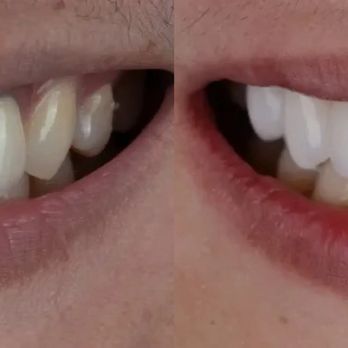 Elegant Dentistry - General Dentistry Near Me - Richfield, Ohio Elegant Dentistry - General Dentistry Near Me - Richfield, Ohio