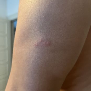 Rancho Magdalena - Bed bug bites - Vacation Rentals Near Me - Valley Center, California Rancho Magdalena - Bed bug bites - Vacation Rentals Near Me - Valley Center, California