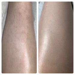 Hailey’s Esthetics - Before and after leg wax