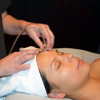 Royale Spa - Face Cupping with facial provided - Hair Removal Near Me - Palatine, Illinois Royale Spa - Face Cupping with facial provided - Hair Removal Near Me - Palatine, Illinois