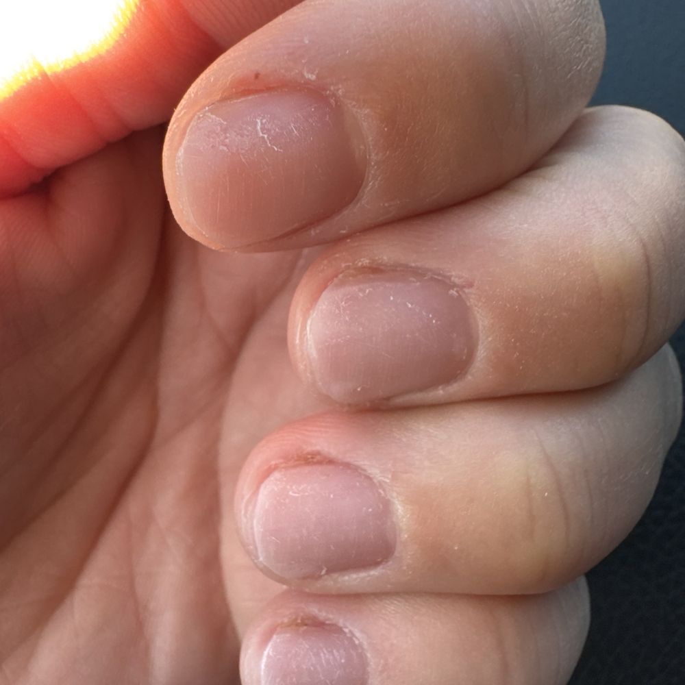 My nails right before she was going to paint them.