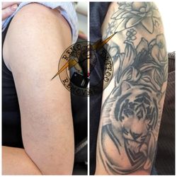 Reno Tattoo Removal