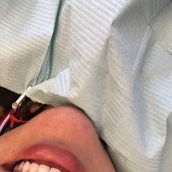 Shojania Natasha, DDS - Getting my new crown