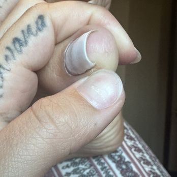 7 Wonders - My ingrown toenail - Nail Salons Near Me - Spokane, Washington