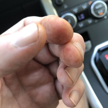 Fortuna's - Stained client fingers due to cleaning stain off of buckles - Shoe Repair Near Me - Bethesda, Maryland