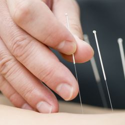 Acupuncture, Chinese Medicine & Rehab Center