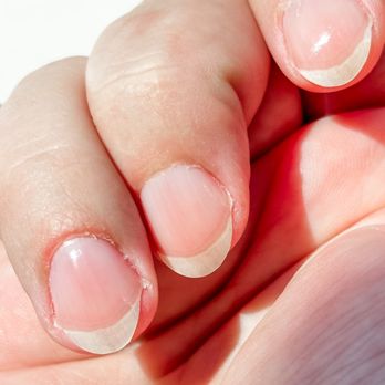Kimmi Spa Nails - Hangnails and skin bits - Nail Salons Near Me - Lakeville, Minnesota Kimmi Spa Nails - Hangnails and skin bits - Nail Salons Near Me - Lakeville, Minnesota