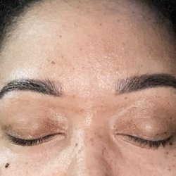 The Beauty Doc - 1 year retouch