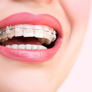 John B Burgess, DDS - Clear Braces - Cosmetic Dentists Near Me - Oak Ridge, Tennessee