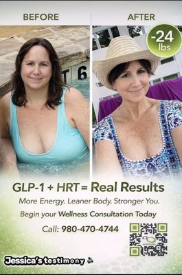 Weight Loss - Peptides and GLP-1 - Unlock a healthier, more confident you with our GLP-1 and advanced peptide weight loss treatments. Designed to support real, sustainable results, these modern therapies help manage appetite, boost metabolism, and make your weight loss journey smoother. Achieve your goals with expert guidance and a personalized approach, all while feeling motivated and supported every step of the way. Start your transformation today—feel and look your best with science-backed solutions. Weight Loss - Peptides and GLP-1 - Unlock a healthier, more confident you with our GLP-1 and advanced peptide weight loss treatments. Designed to support real, sustainable results, these modern therapies help manage appetite, boost metabolism, and make your weight loss journey smoother. Achieve your goals with expert guidance and a personalized approach, all while feeling motivated and supported every step of the way. Start your transformation today—feel and look your best with science-backed solutions.