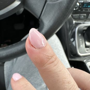 Coffee N Nails - Infected finger - Nail Salons Near Me - Austin, Texas Coffee N Nails - Infected finger - Nail Salons Near Me - Austin, Texas