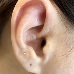 Healing Arts Center - Ear seeding