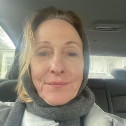 The Skin Studio - No filter. Yup 70!