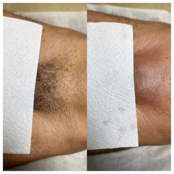 A Smooth Affair - Gentzilian (Men's Brazilian wax)